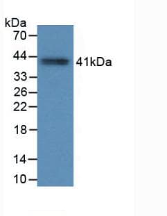 TPSAB1 / Mast Cell Tryptase Antibody