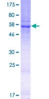 Human DUS4L Protein (Recombinant GST)