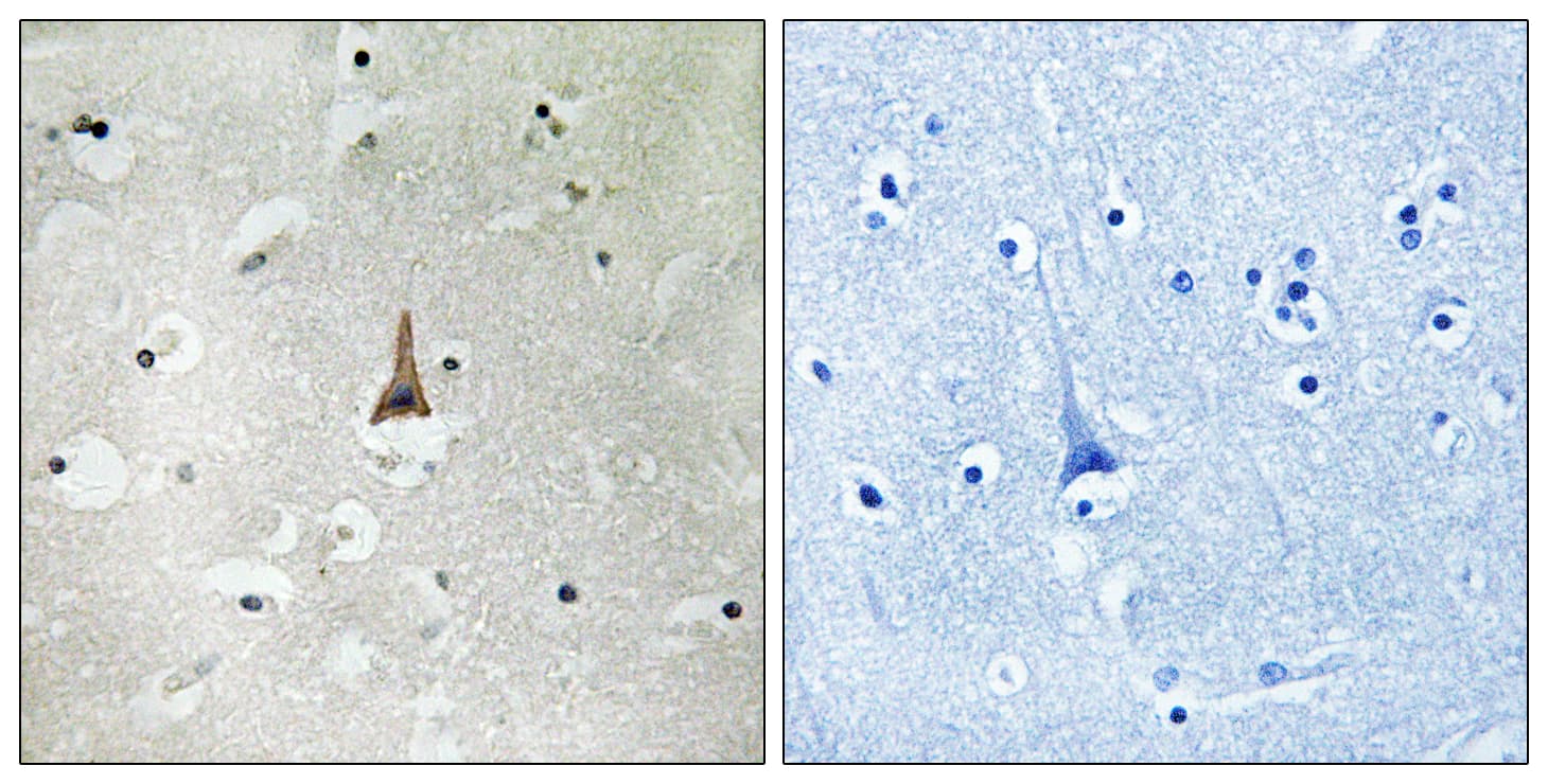 LRP10 Antibody (aa204-253)