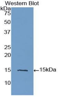 INHBA / Inhibin Beta A Antibody (aa311-426)