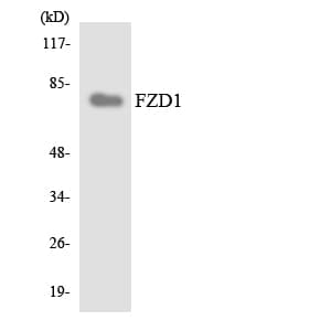 IHC-plus™ FZD1 / Frizzled 1 Antibody (aa6-55)