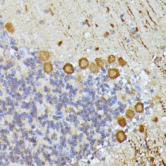 ELP3 Antibody