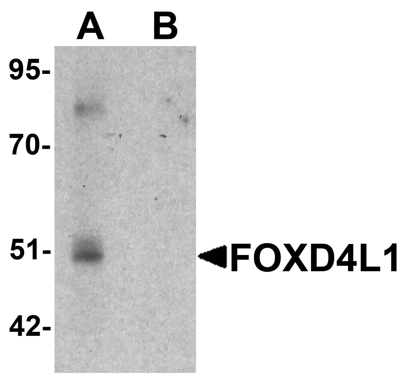 FOXD4L1 / FOXD5 Antibody