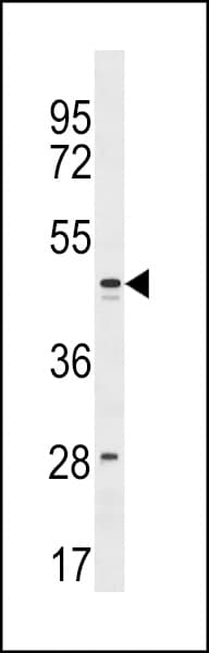 Polyclonal Rabbit anti-Human FAM155B / TMEM28 Antibody (aa358-384, WB)