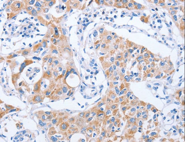 Polyclonal Rabbit anti-Human KIF3A Antibody (IHC, WB)