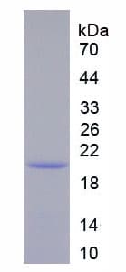 Human IL12RB1 / CD212 Protein (Recombinant His)