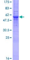 Human TXNDC1 / TMX1 Protein (Recombinant GST, N-terminus)