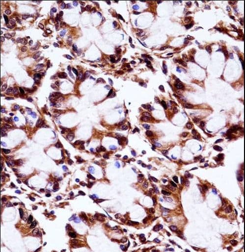 Polyclonal Rabbit anti-Human ARA9 / AIP Antibody (aa293-321, IHC, WB)