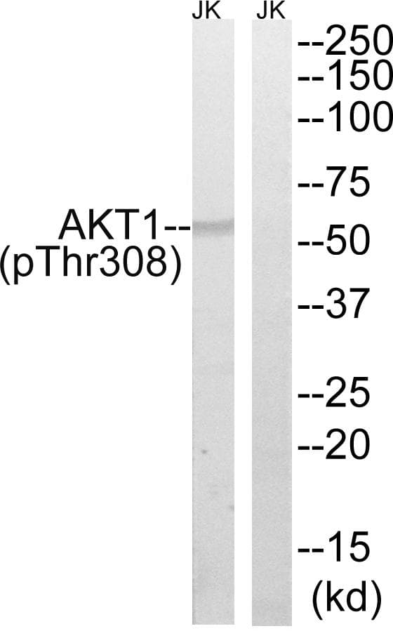 Polyclonal Rabbit anti-Human AKT1 Antibody (phospho-Thr308, IHC, WB)