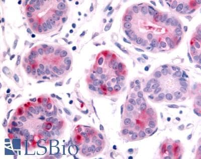 PathPlus™ Polyclonal Rabbit anti-Human HUNK / B19 Antibody (Kinase Domain, IHC)