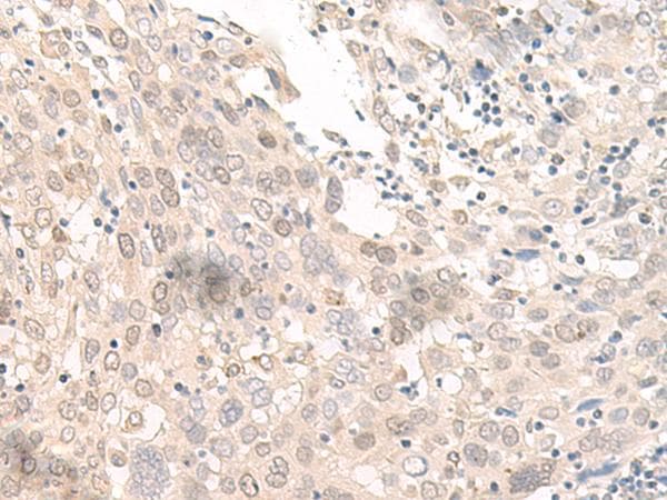 Polyclonal Rabbit anti-Human OLA1 Antibody (IHC, WB)
