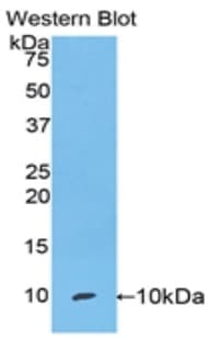 SCGB1A1 / Uteroglobin Antibody (aa22-96)