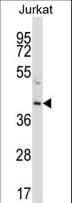 PROC / Protein C Antibody (aa177-206)