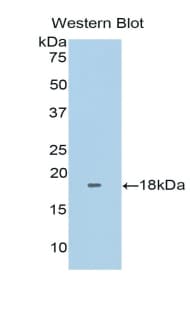 FNDC5 / Irisin Antibody (aa2-137)