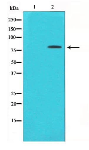 Polyclonal Rabbit anti-Human PRKCD / PKC-Delta Antibody (phospho-Tyr313, IHC, WB)