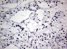 AFAP1 / AFAP Antibody (aa100-386, clone OTI2G9)
