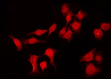 IVL / Involucrin Antibody