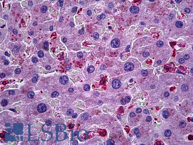 IHC-plus™ Polyclonal Goat anti-Human CCL20 / MIP-3-Alpha Antibody (aa33-44, IHC)