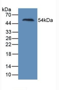 HAVCR1 / KIM-1 Antibody (Biotin)
