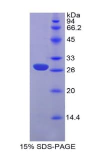 Human HGF / Hepatocyte Growth Factor Protein (Recombinant His)