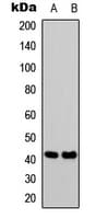 SSTR1 Antibody (N-Terminus)