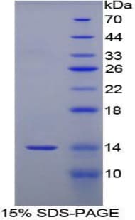 Human Serum Amyloid A Protein (Recombinant His)