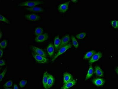 Polyclonal Rabbit anti-Human SLC41A2 Antibody (IHC, WB)