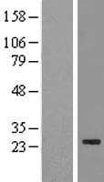 METTL21B / FAM119B Protein (Over-Expression Lysate Myc-DDK (Flag))
