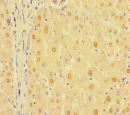 RIT1 Antibody