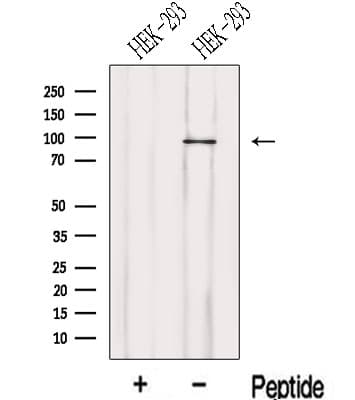 Polyclonal Rabbit anti-Human LENG8 Antibody (WB)