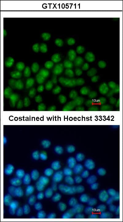 Polyclonal Rabbit anti-Human NKX2-5 Antibody (aa1-218, WB)