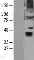 Human WNT6 Protein (Over-Expression Lysate Myc-DDK (Flag))