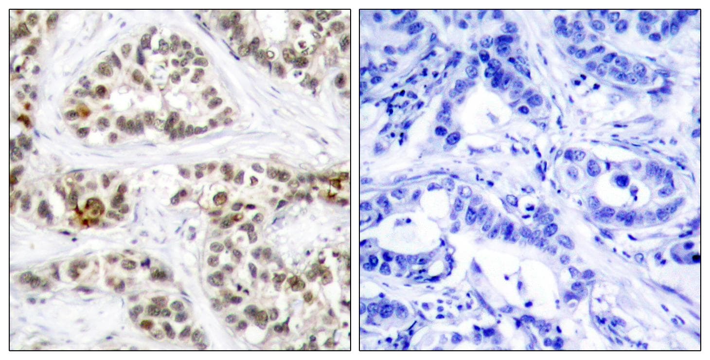 RELB Antibody (phospho-Ser552)