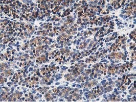 OSBP Antibody (clone OTI1F2)
