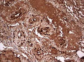 Monoclonal Mouse anti-Human GAPDH Antibody (clone OTI2F8, IHC, WB)