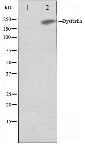 Polyclonal Rabbit anti-Human Dysferlin Antibody (WB)