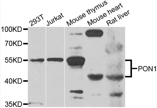 Polyclonal Rabbit anti-Human PON1 / ESA Antibody (IHC, WB)