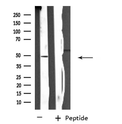 SH2D2A Antibody