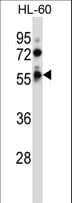 Polyclonal Rabbit anti-Human FKRP Antibody (aa237-265, WB)