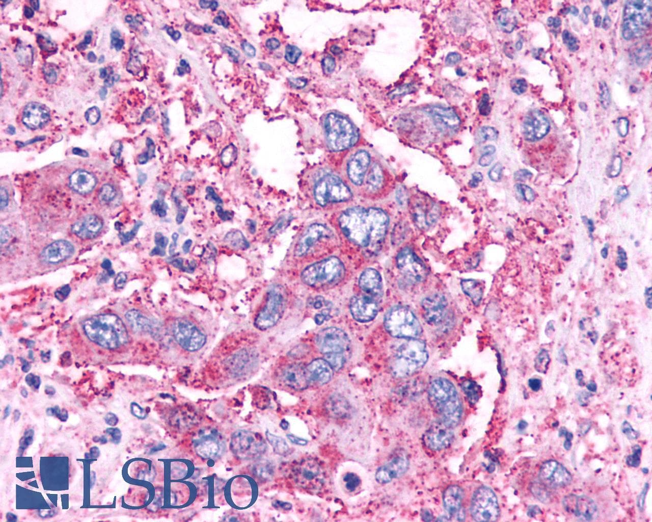 PathPlus™ NPY4R / PPYR1 Antibody (Extracellular Domain)