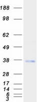 Human TMX2 / TXNDC14 Protein (Recombinant Myc-DDK (Flag))