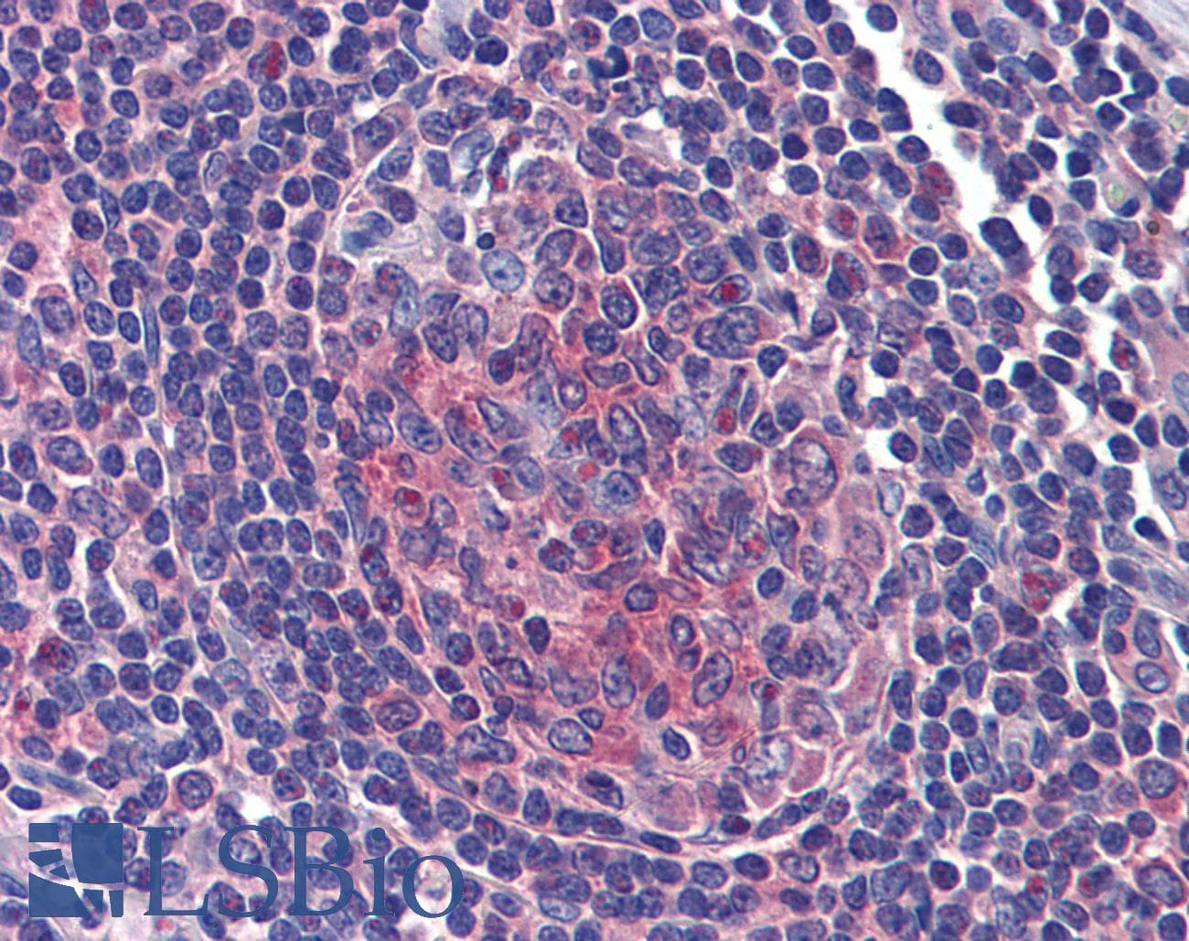 IHC-plus™ URP2 / FERMT3 Antibody
