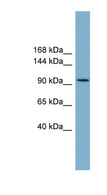 SLC12A3 / TSC Antibody (C-Terminus)