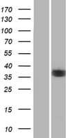NEK6 Protein (Over-Expression Lysate Myc-DDK (Flag))