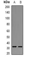 GSTT1 Antibody
