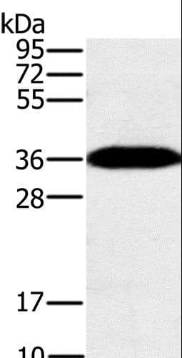 PPP1CC / PP1 Gamma Antibody