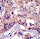 p56lck / LCK Antibody (aa23-52)