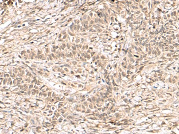 RPS6KA5 / MSK1 Antibody