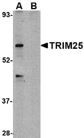 IHC-plus™ Polyclonal Rabbit anti-Human TRIM25 Antibody (IHC, IF, WB)