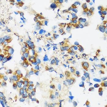 Polyclonal Rabbit anti-Human APOBEC3F / ARP8 Antibody (IHC)